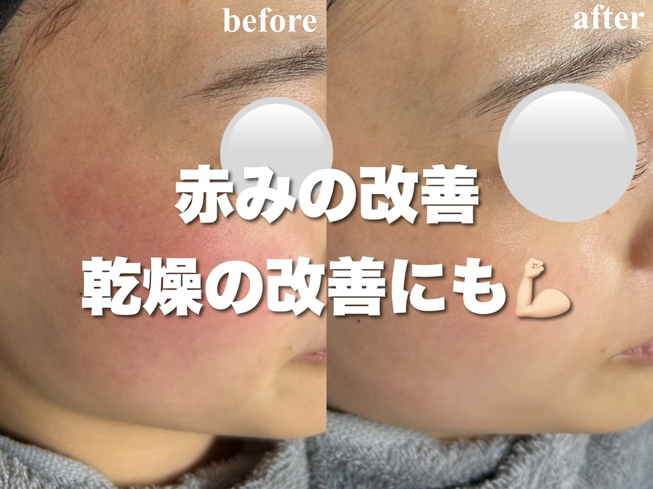 画像350