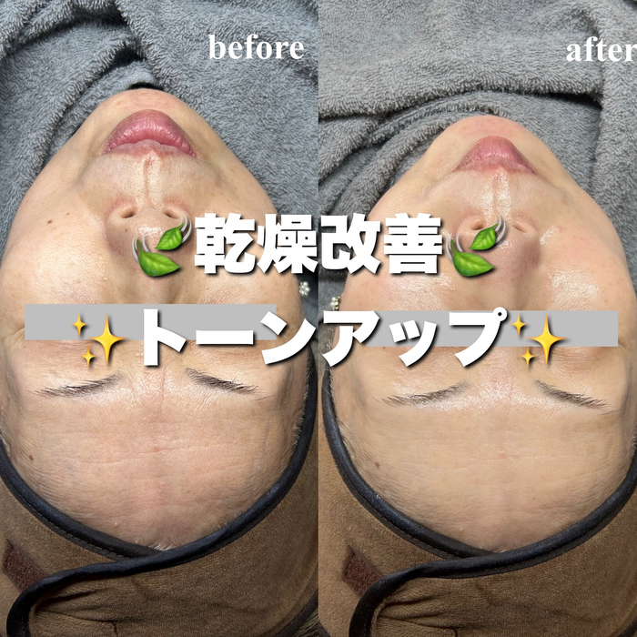 画像371