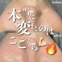 画像528