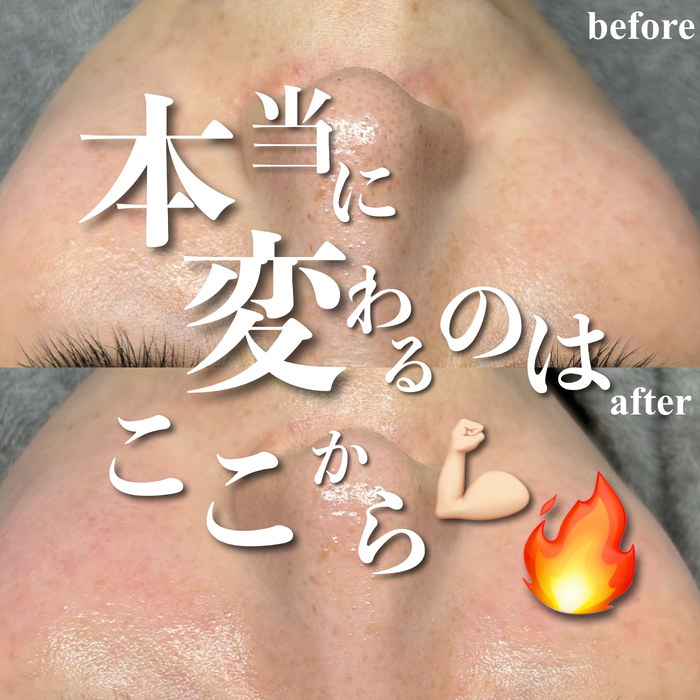 画像528