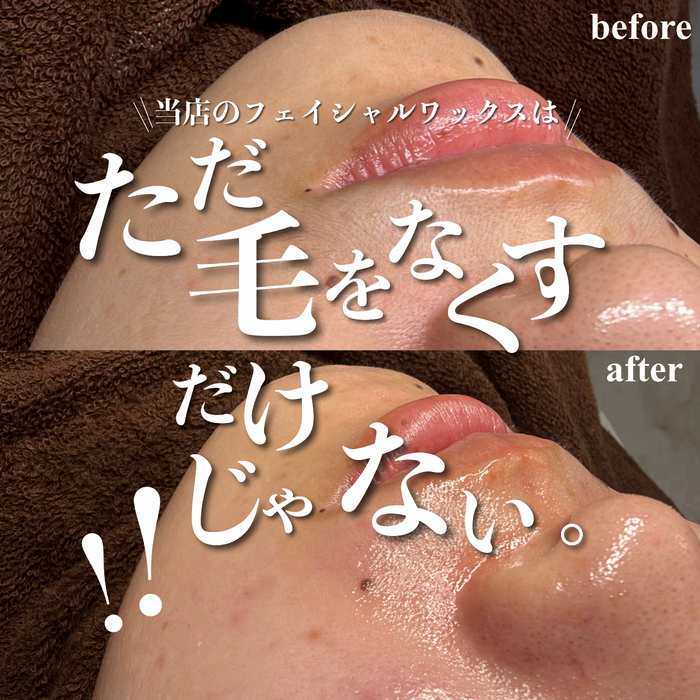 画像661